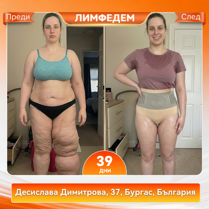 🎉🎁Официален магазин |𝐕𝐄𝐋𝐍𝐎𝐑𝐀® 𝟐𝟎𝟐𝟔 МОРИНГА И БЕРБЕРИН 4 B 1 Къси Панталони За Скулптуриране С Микрочастици И Изгаряне На Мазнини